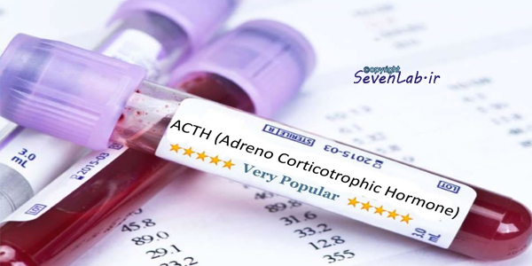 ACTH Test SevenLab.ir