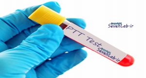 زمان ترومبوپلاستین نسبی خون (PTT)
