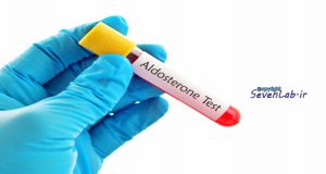 Aldosterone Test | SevenLab.ir
